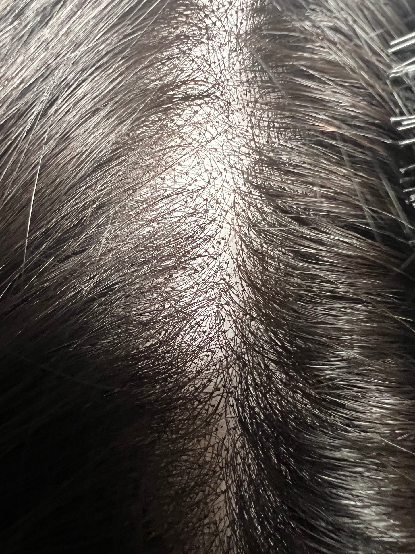 Natural 1B HD 9x6 inches Glueless Mini Frontal Lace Closure