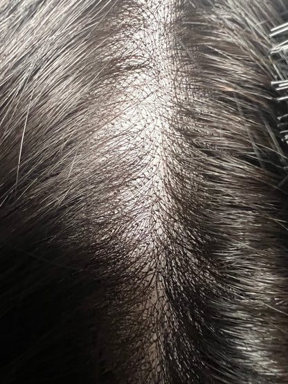 Natural 1B HD 9x6 inches Glueless Mini Frontal Lace Closure